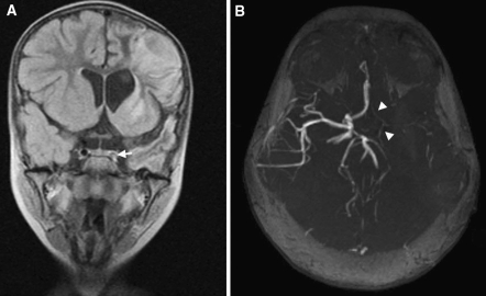 Fig. 1
