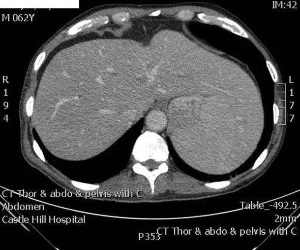 Figure 1