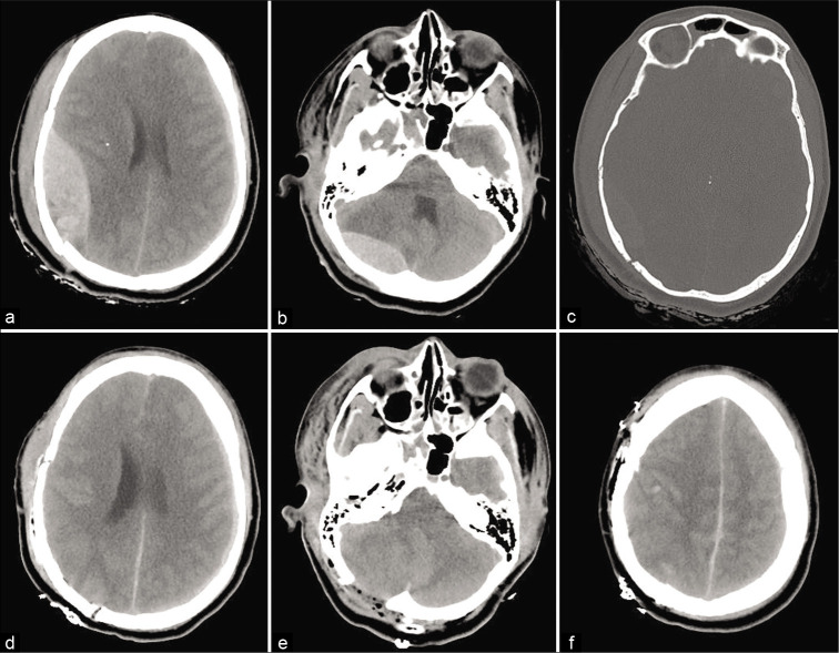 Figure 1: