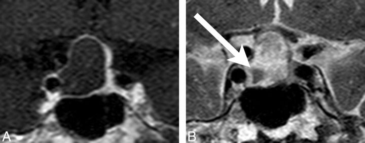 Fig 6.