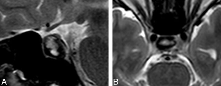 Fig 2.