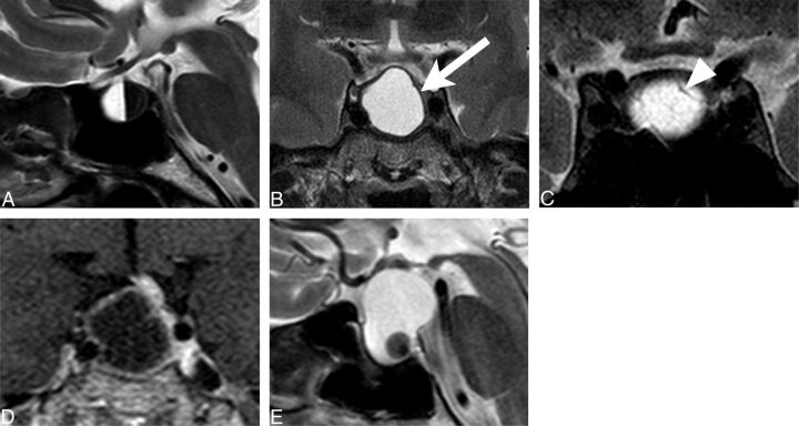 Fig 1.