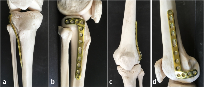 Fig. 2