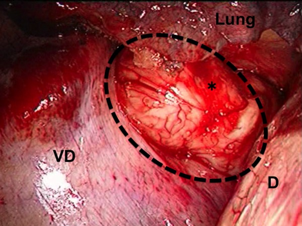 Figure 3: