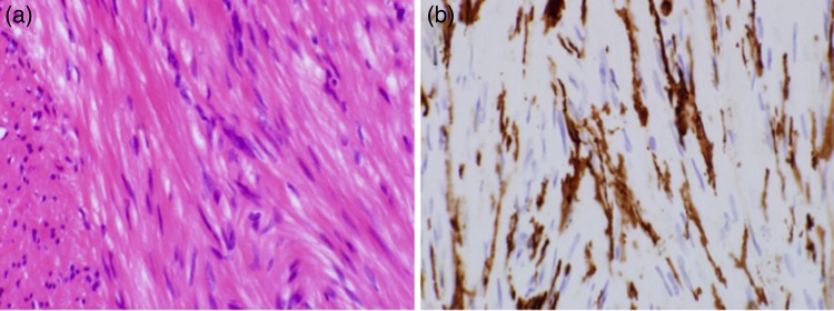 Figure 4: