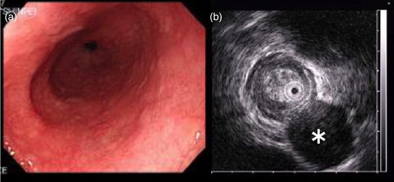 Figure 2: