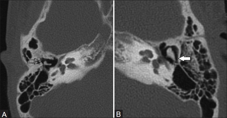 Figure 1 (A, B)