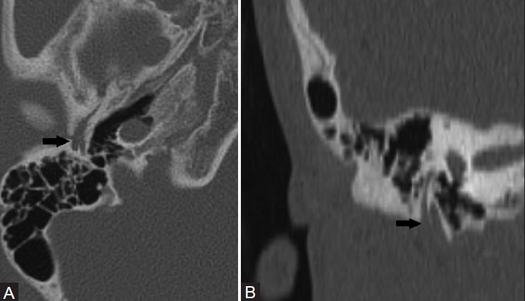 Figure 2 (A, B)