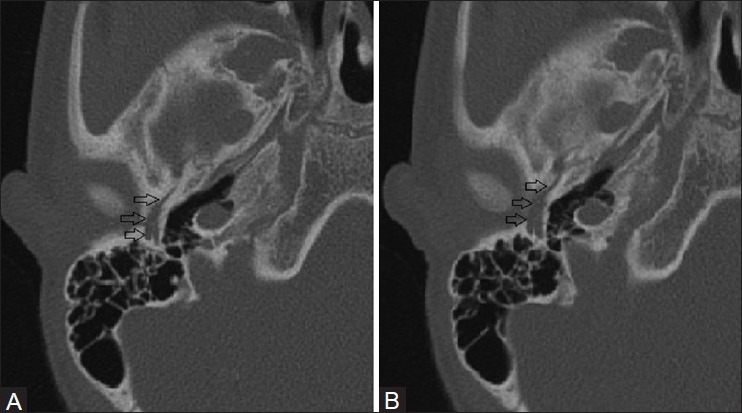 Figure 3 (A, B)