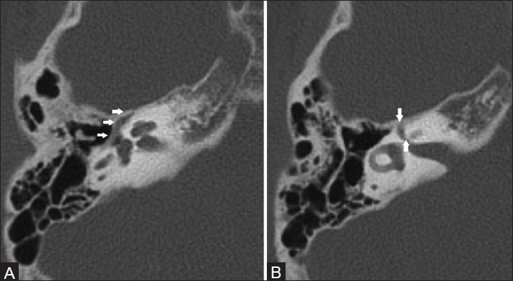 Figure 4 (A, B)