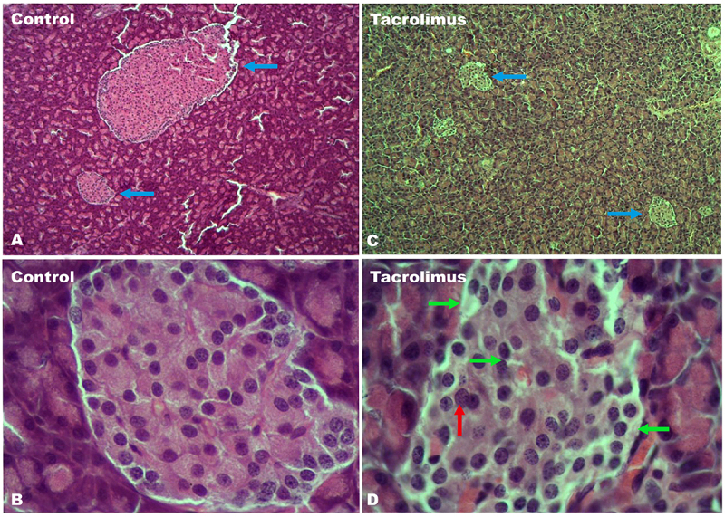 Figure 11.