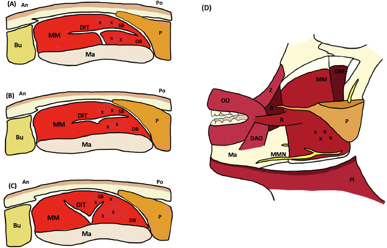 Fig 1