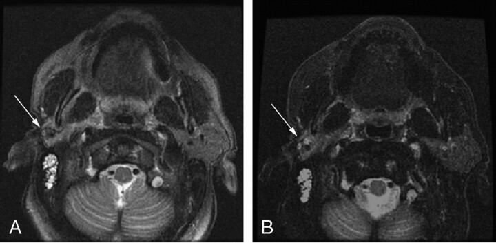 Fig 1.