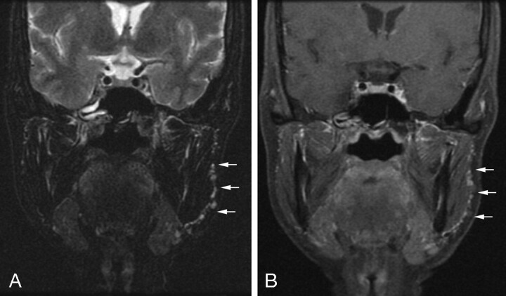 Fig 2.