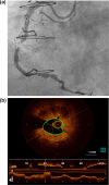 Fig. 4