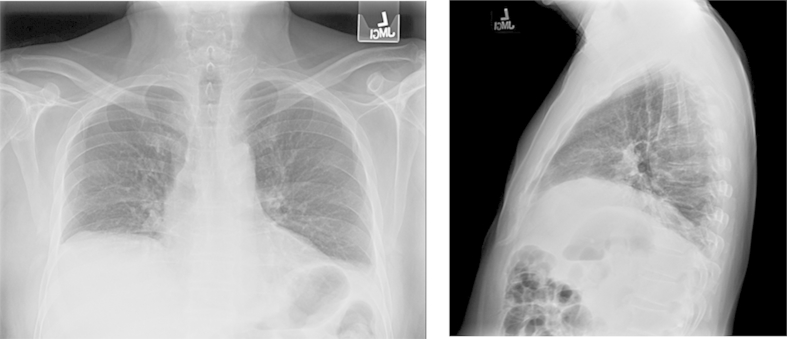 Fig. 1