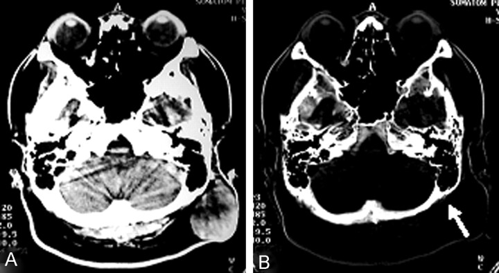 Fig 2.