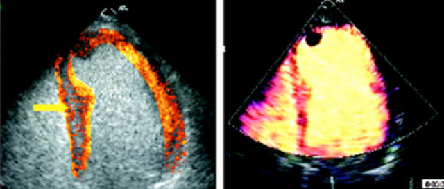 Figure 2  