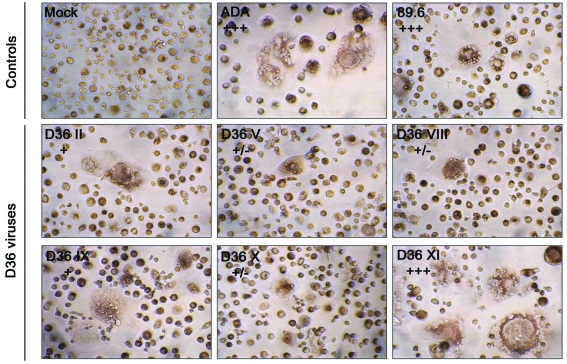 Fig. (3). Syncytium formation in MDM induced by nef-deleted viruses