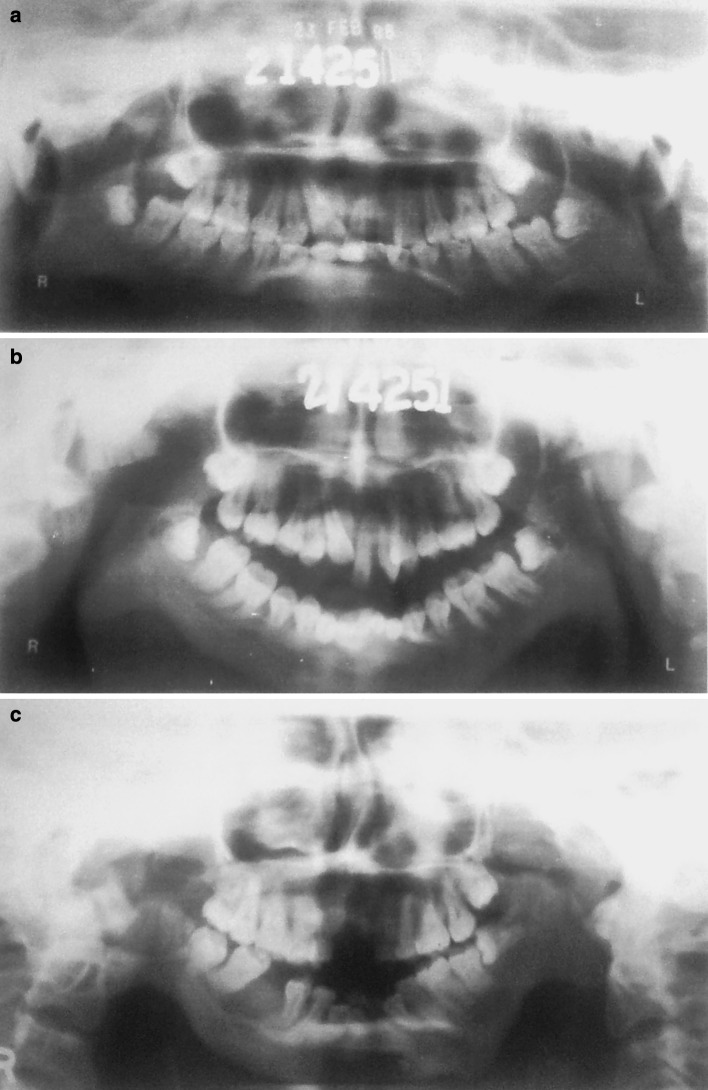 Fig. 3