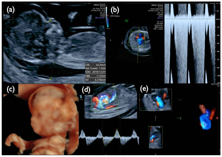 Figure 12