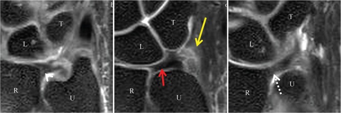 Fig 6.