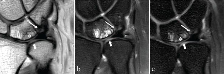 Fig 14.