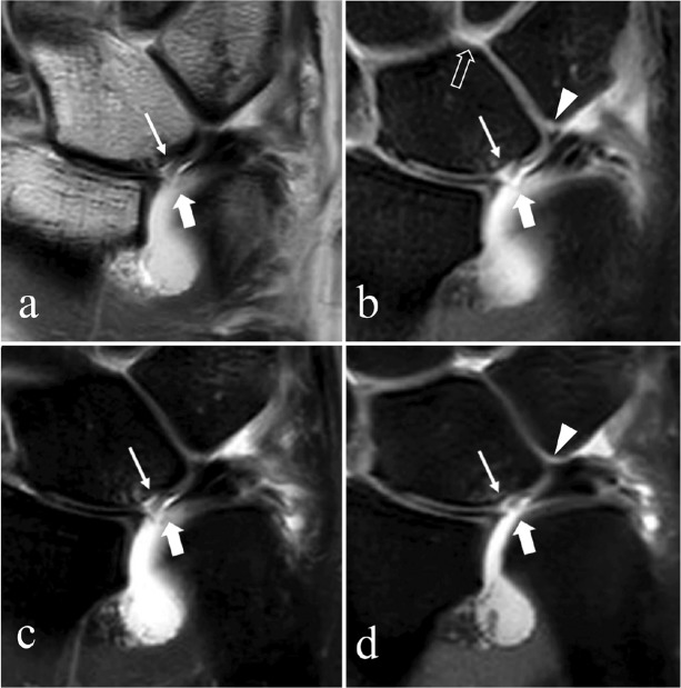 Fig 15.