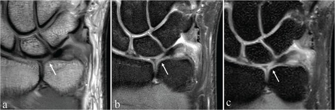 Fig 11.