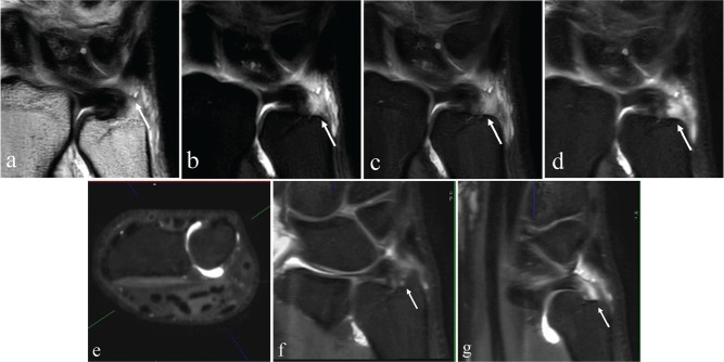 Fig 12.