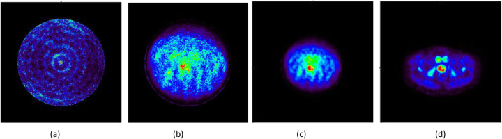Fig. 15
