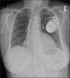 Figure 2)