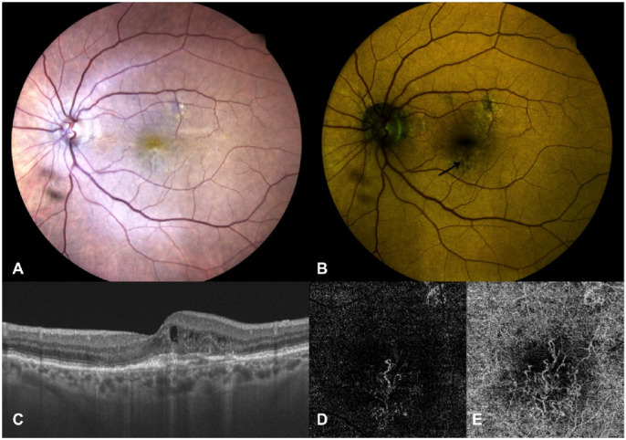 Figure 3.