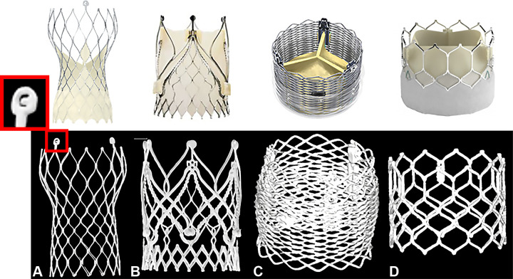 Transcatheter heart valves scanned ex vivo in ultra-high-resolution (UHR) mode with photon-counting detector CT. Four different ex vivo transcatheter heart valves were scanned in UHR mode with 140 kV and reconstructed with a Qr89/Qr76 kernel at quantum iterative reconstruction strength 4. CT images are displayed as three-dimensional volume-rendered images: (A) CoreValve Evolut R (Medtronic), (B) JenaValve (JenaValve Technology), (C) Lotus Edge (Boston Scientific), (D) SAPIEN 3 Ultra TM transcatheter heart valve (Edwards Lifesciences). (Reprinted, with permission, from Medtronic, JenaValve Technology, ©2023 Boston Scientific Corporation, and Edwards Lifesciences Corporation, respectively. All rights reserved.)