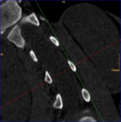 Fig. 2