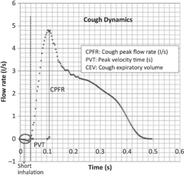 Fig. 11