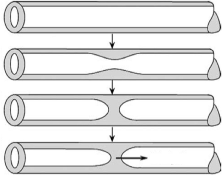 Fig. 17