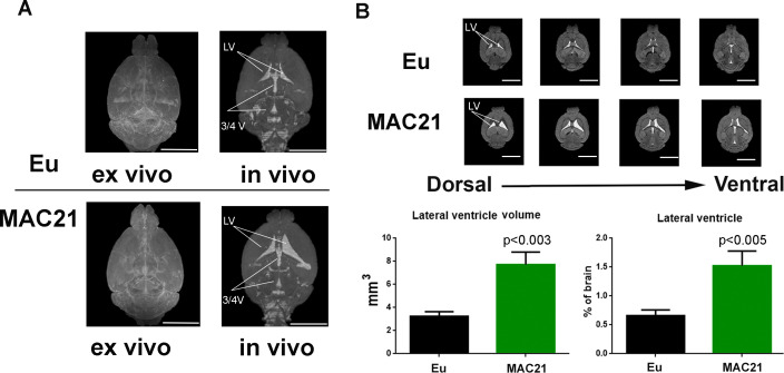 Figure 4—figure supplement 1.