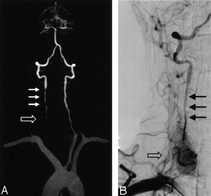 Fig 3.