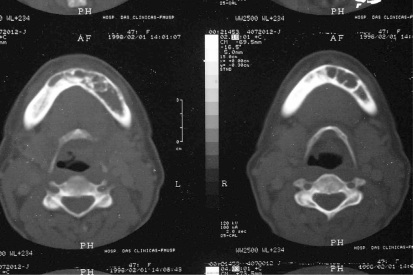 Figure 4 -