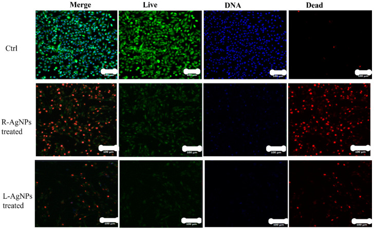 Figure 15