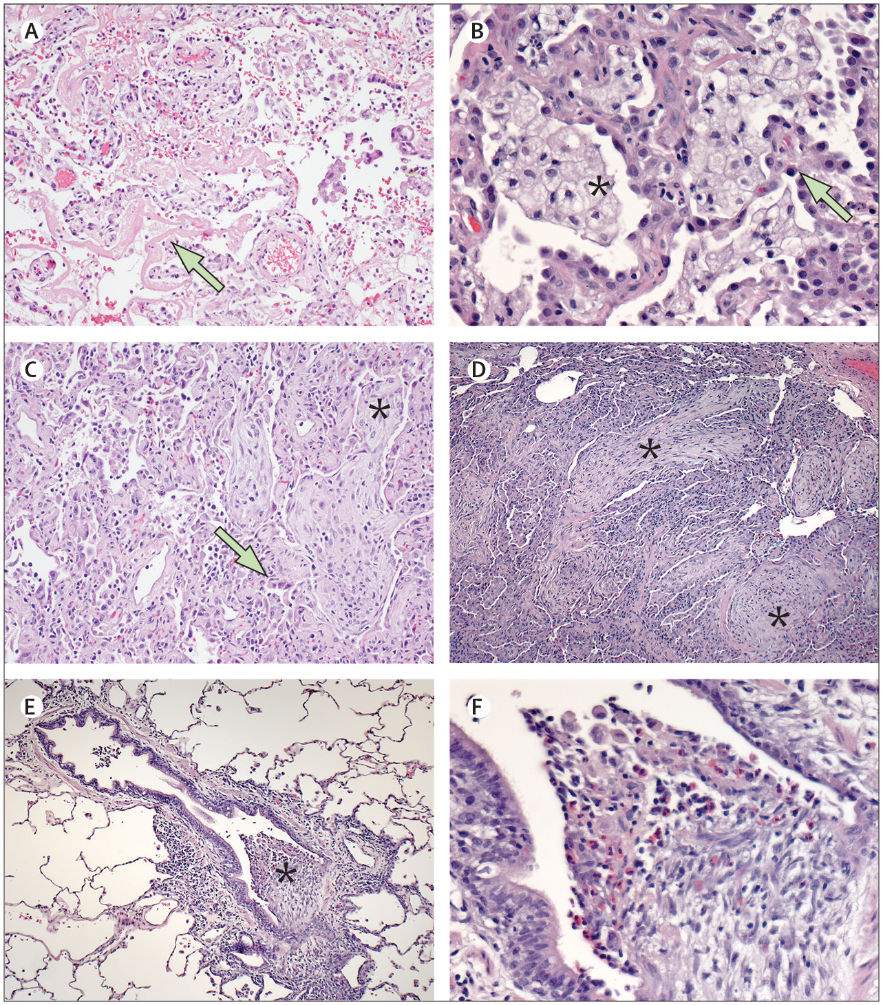 Figure 1: