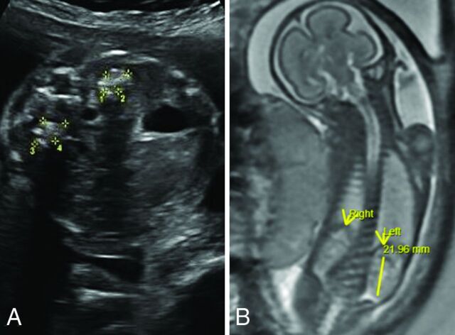 FIG 4.