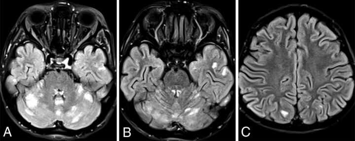 FIG 3.