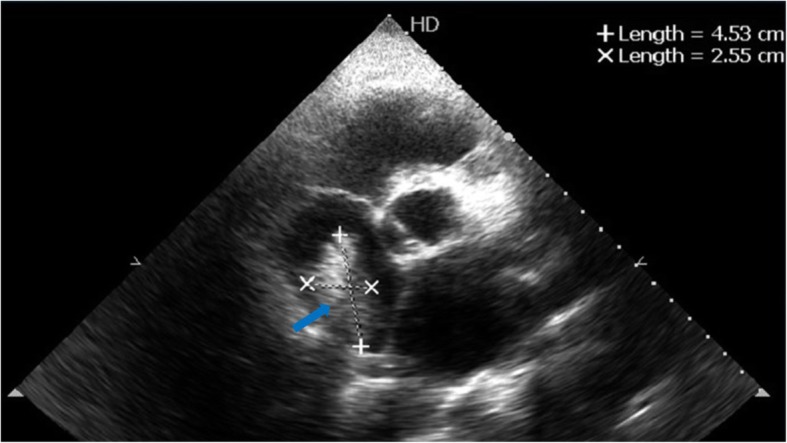 Fig. 2