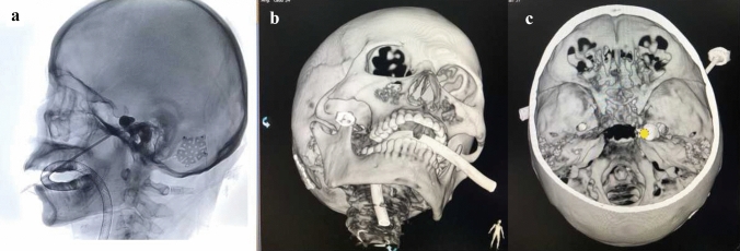Fig. 3