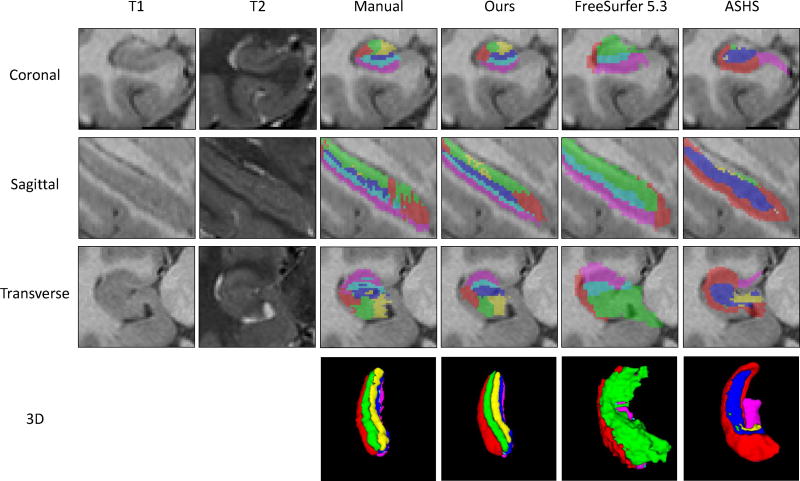 Figure 11