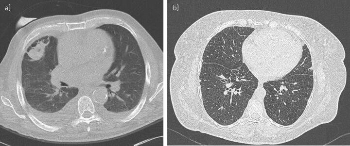 FIGURE 1