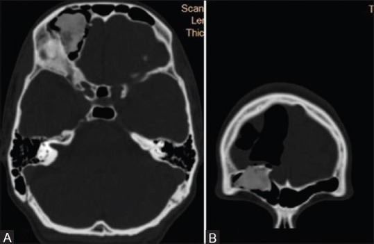 Figure 3 (A and B)