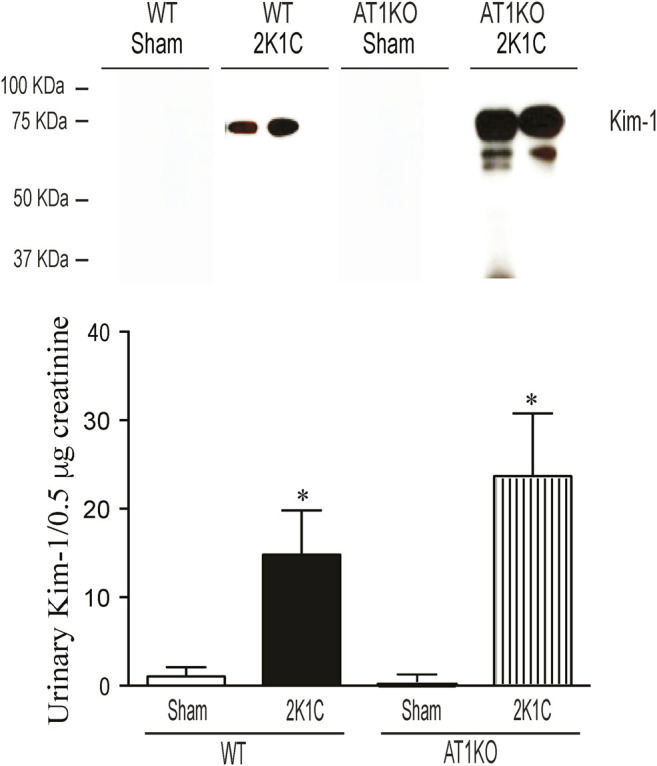 FIGURE 11